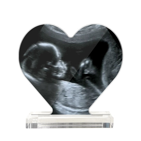 First Glimpse Forever Custom Ultrasound Heart-Shaped Acrylic Plaque for Mom-to-Be